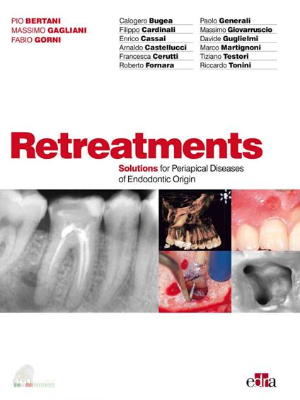 Retreatments