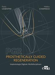 PGR. Prosthetically guided regeneration. Implantologia Digitale Multidisciplinare
