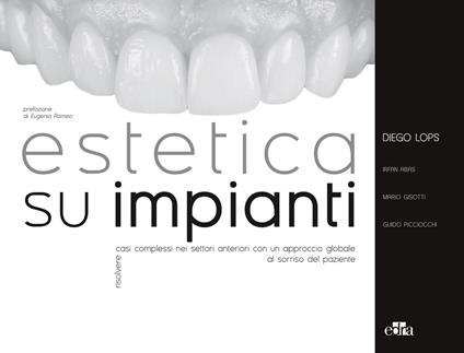 Estetica su impianti. Risolvere casi complessi nei settori anteriori con un approccio globale al sorriso del paziente - Diego Lops,Mario Gisotti,Guido Picciocchi - copertina
