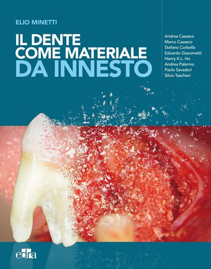 Il dente come materiale da innesto - Andrea Carasco,Marco Carasco,Edoardo Giacometti,Henry K.L. Ho - ebook