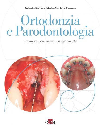 Ortodonzia e parodontologia. Trattamenti combinati e sinergie cliniche - Roberto Kaitsas,Maria Giacinta Paolone - copertina