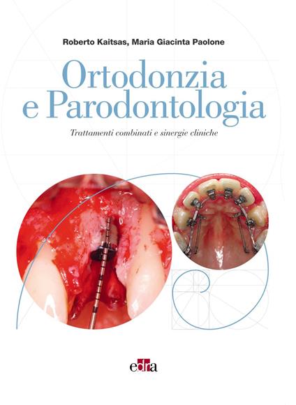 Ortodonzia e parodontologia. Trattamenti combinati e sinergie cliniche - Roberto Kaitsas,Maria Giacinta Paolone - ebook