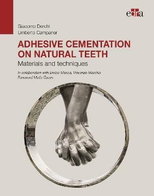Adhesive cementation on natural teeth. Materials and techniques - Giacomo Derchi,Umberto Campaner - copertina
