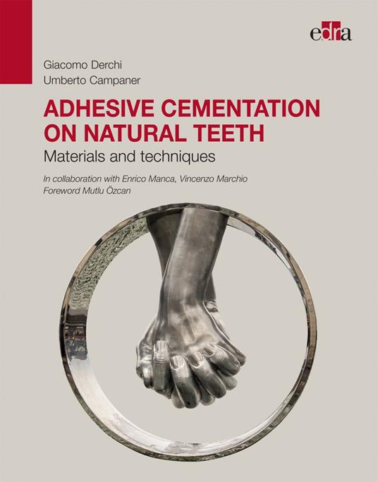 Adhesive cementation on natural teeth