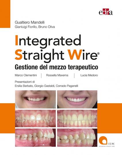 Integrated straight wire. Gestione del mezzo terapeutico - Gualtiero Mandelli,Gianluigi Fiorillo,Bruno Oliva - copertina