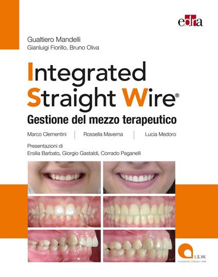 Integrated straight wire. Gestione del mezzo terapeutico - Gianluigi Fiorillo,Gualtiero Mandelli,bruno oliva - ebook