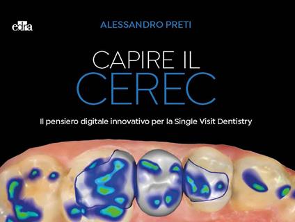 Capire il CEREC. Il pensiero digitale innovativo per la Single Visit Dentistry - Alessandro Preti - copertina