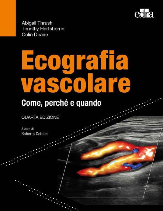 Ecografia vascolare. Come, perché e quando - Abigail Thrush,Timothy Hartshorne,Colin Deane - copertina
