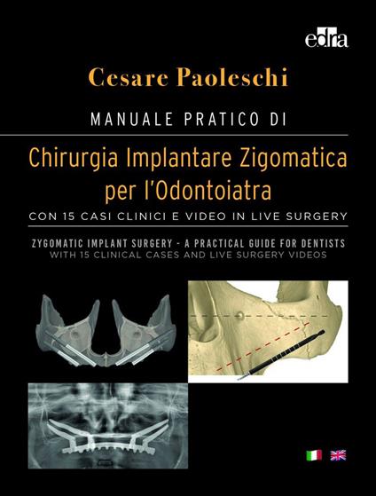 Manuale pratico di chirurgia implantare zigomatica per l'odontoiatra. Con 15 casi clinici e video in live surgery-Zygomatic implant surgery. A practical guide for dentist. With 15 clinical cases and live surgery videos. Ediz. a colori. Con DVD video - Cesare Paoleschi - copertina