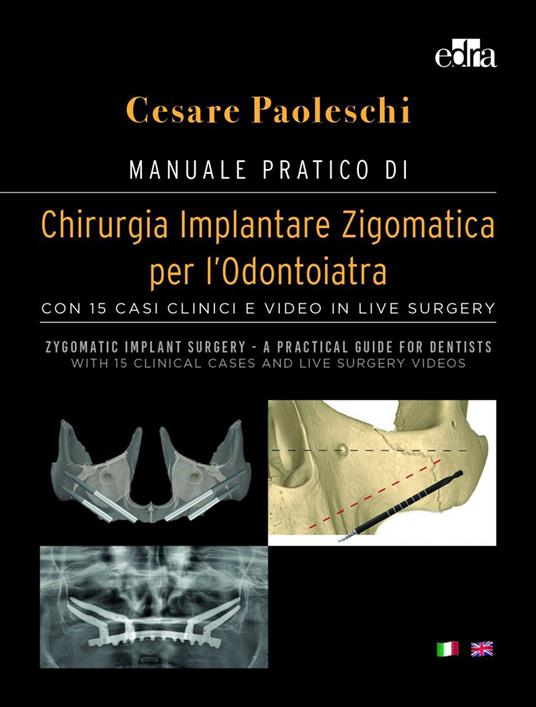 Manuale pratico di chirurgia implantare zigomatica per l'odontoiatra. Con 15 casi clinici e video in live surgery-Zygomatic implant surgery. A practical guide for dentist. With 15 clinical cases and live surgery videos. Ediz. a colori. Con DVD video - Cesare Paoleschi - copertina