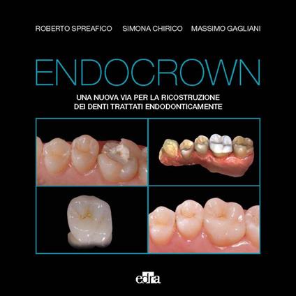 Endocrown. Una nuova via per la ricostruzione dei denti trattati endodonticamente - Roberto Spreafico,Simona Chirico,Massimo Gagliani - copertina