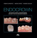 Endocrown. Una nuova via per la ricostruzione dei denti trattati endodonticamente
