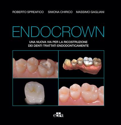 Endocrown. Una nuova via per la ricostruzione dei denti trattati endodonticamente - Simona Chirico,Massimo Gagliani,Roberto Spreafico - ebook