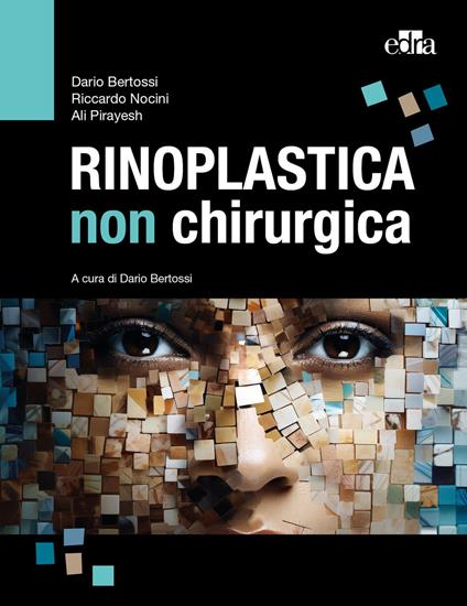 Rinoplastica non chirurgica - Dario Bertossi,Riccardo Nocini,Ali Pirayesh - copertina