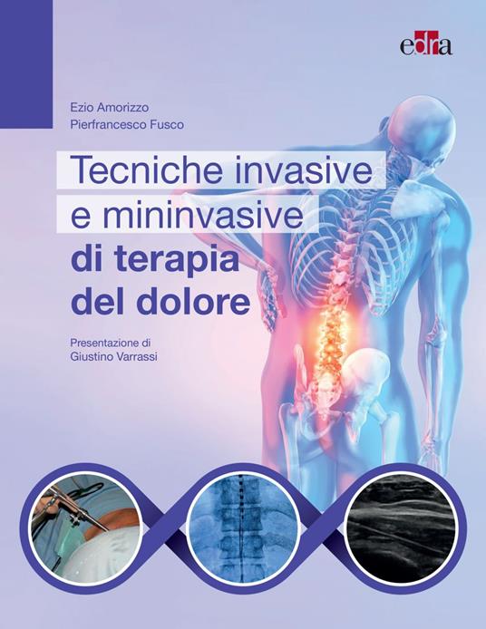 Tecniche invasive e mininvasive di terapia del dolore - Ezio Amorizzo,Pierfrancesco Fusco - ebook
