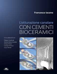 L'otturazione canalare con cementi bioceramici