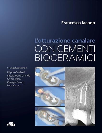 L'otturazione canalare con cementi bioceramici - Francesco Iacono - copertina