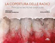 La copertura delle radici. Principi e tecniche avanzate