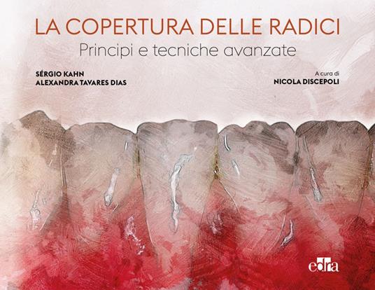 La copertura delle radici. Principi e tecniche avanzate - Sérgio Kahn,Alexandra Tavares Diaz,Nicola Discepoli - ebook