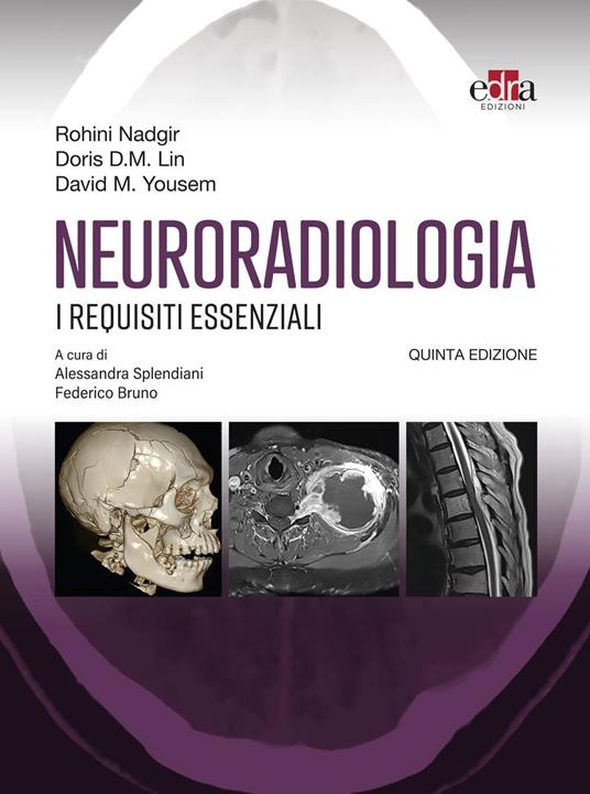 Neuroradiologia - Doris D. M.  Lin,David M. Yousem,Rohini Nadgir,Federico Bruno - ebook