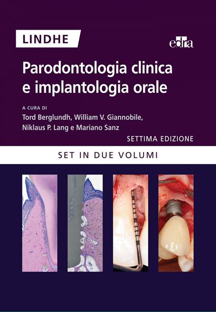 Parodontologia clinica e implantologia orale. Vol. 1-2 - Jan Lindhe,Tord Berglundh,William V. Giannobile,Niklaus P. Lang - ebook
