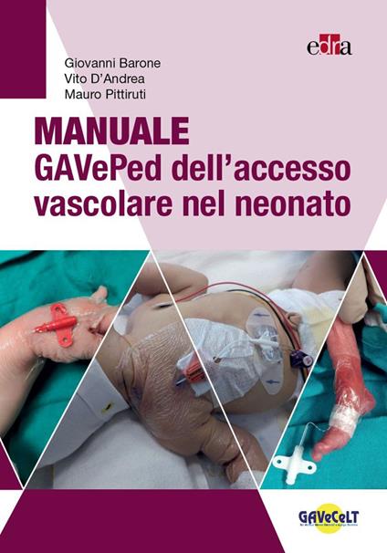 Manuale GAVePed dell'accesso vascolare nel neonato - Giovanni Barone,Vito D'Andrea,Mauro Pittiruti - copertina