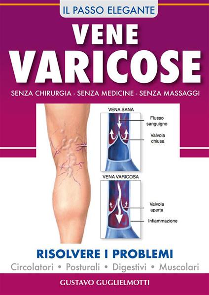 Vene varicose. Prevenire, ridurre ed elliminare - Gustavo Guglielmotti - ebook