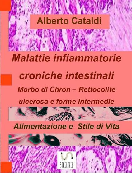 Malattie infiammatorie croniche intestinali. Alimentazione e stile di vita - Alberto Cataldi - ebook