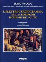 L' elettrocardiogramma nelle sindromi ischemiche acute