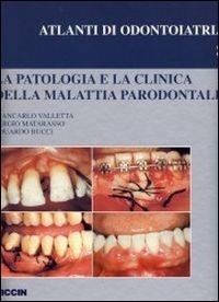 La patologia e la clinica della malattia parodontale - Giancarlo Valletta,Sergio Matarasso,Eduardo Bucci - copertina