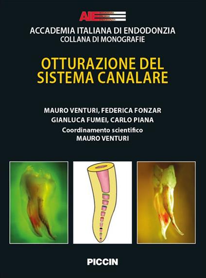 Otturazione del sistema canalare - Mauro Venturi,Federica Fonzar,Gianluca Fumei - copertina