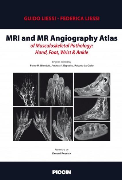 MRI and MR angiography atlas of musculoskeletal pathology: hand, foot, wrist & ankle - Guido Liessi,Federica Liessi - copertina