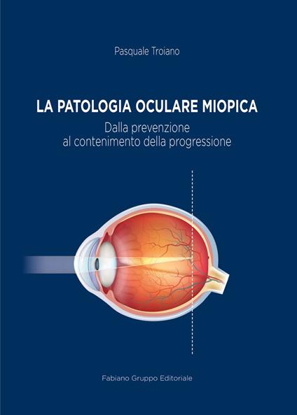 La patologia oculare miopica. Dalla prevenzione al contenimento della progressione - Pasquale Troiano - copertina