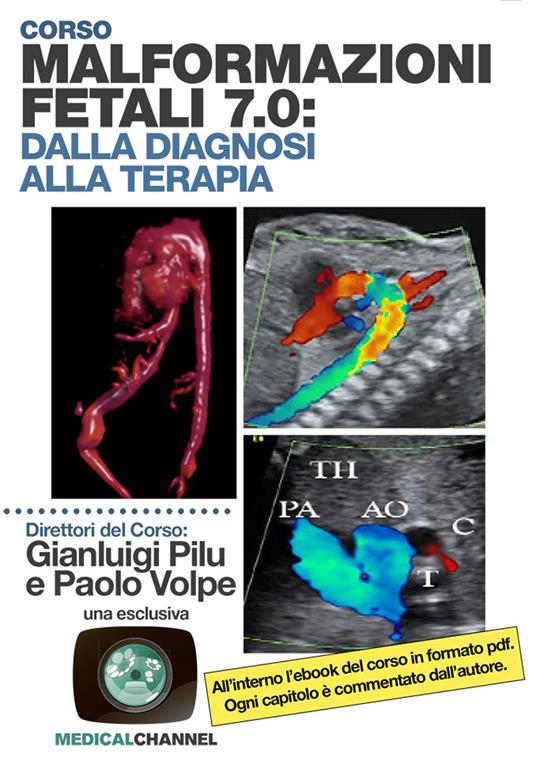 Malformazioni fetali 7.0: dalla diagnosi alla terapia - Gianluigi Pilu,Paolo Volpe - copertina