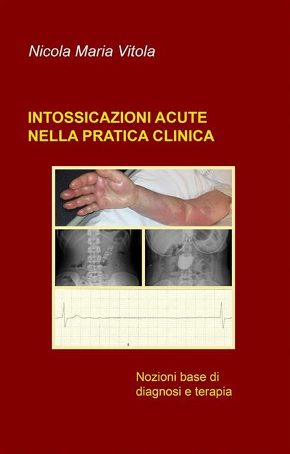 Intossicazioni acute nella pratica clinica. Nozioni base di diagnosi e terapia - Nicola Maria Vitola - ebook