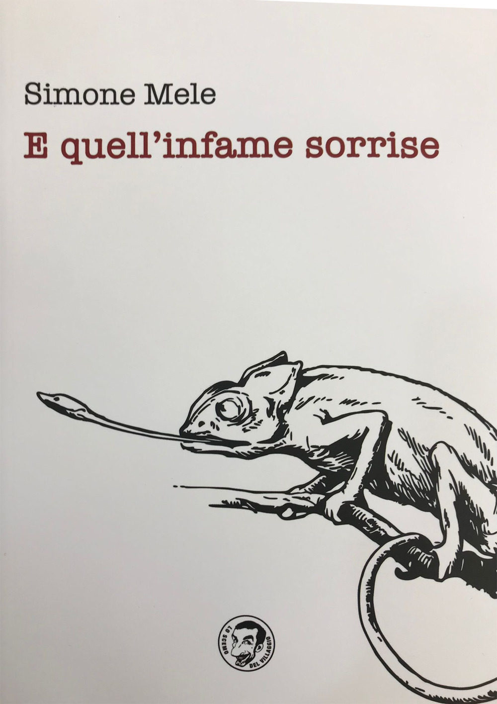 ibs