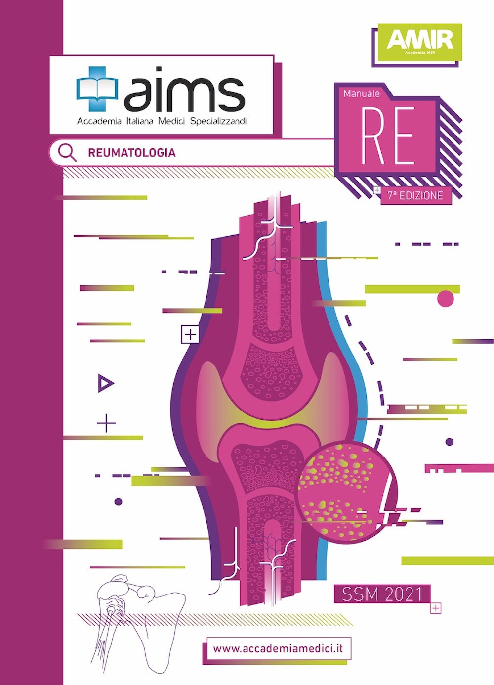 ibs