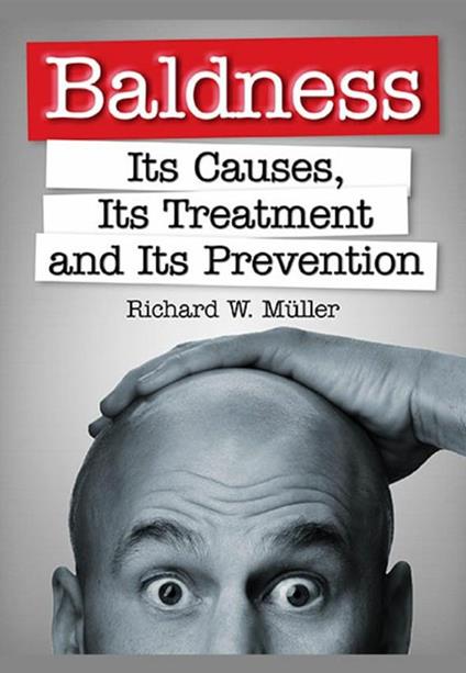 Baldness. Its causes, its treatment and its prevention - Richard W. Müller - copertina
