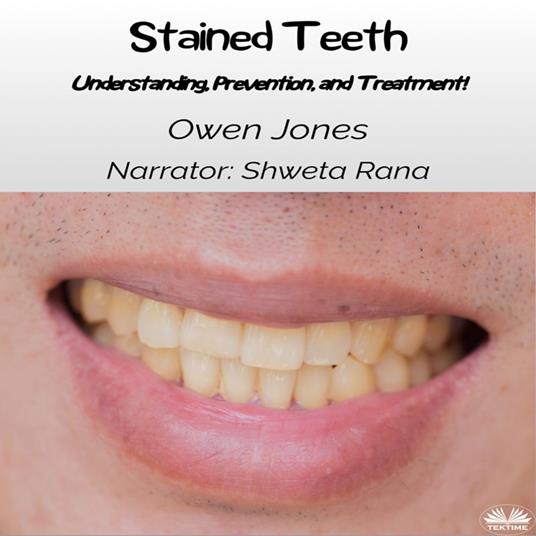 Stained Teeth