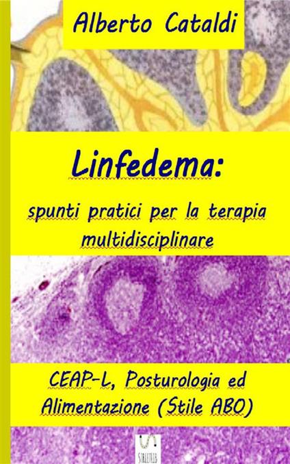 Linfedema. Spunti pratici per la terapia multidisciplinare - Alberto Cataldi - ebook