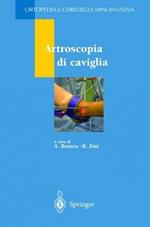 Artroscopia di caviglia