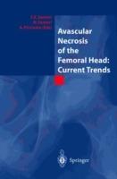 Avascular necrosis of the femoral head. Current trends