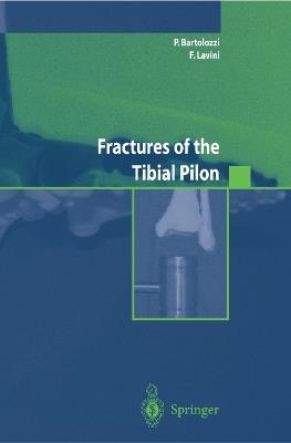 Fractures of the tibial pilon. Ediz. inglese - copertina