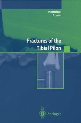 Fractures of the tibial pilon. Ediz. inglese - copertina