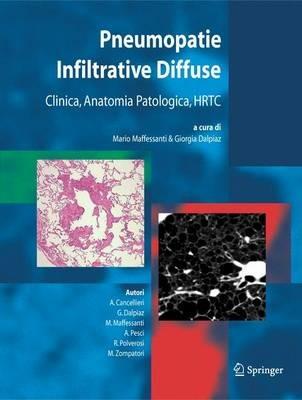 Pneumopatie infiltrative diffuse. Clinica, anatomia patologica, HRTC - copertina
