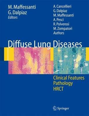 Diffuse lung diseases. Clinical features, pathology, HRCT - Mario Maffessanti,Giorgia Dalpiaz,Alessandra Cancellieri - copertina