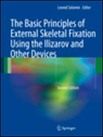 The basic principles of skeletal fixation using the Ilizarov and other devices