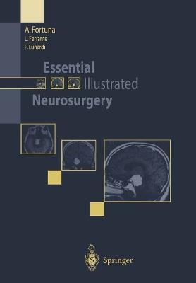 Essential Illustrated Neurosurgery - A. Fortuna,L. Ferrante,P. Lunardi - cover
