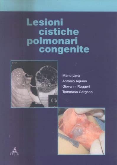 Lesioni cistiche polmonari congenite - Mario Lima,Antonio Aquino,Giovanni Ruggeri - copertina