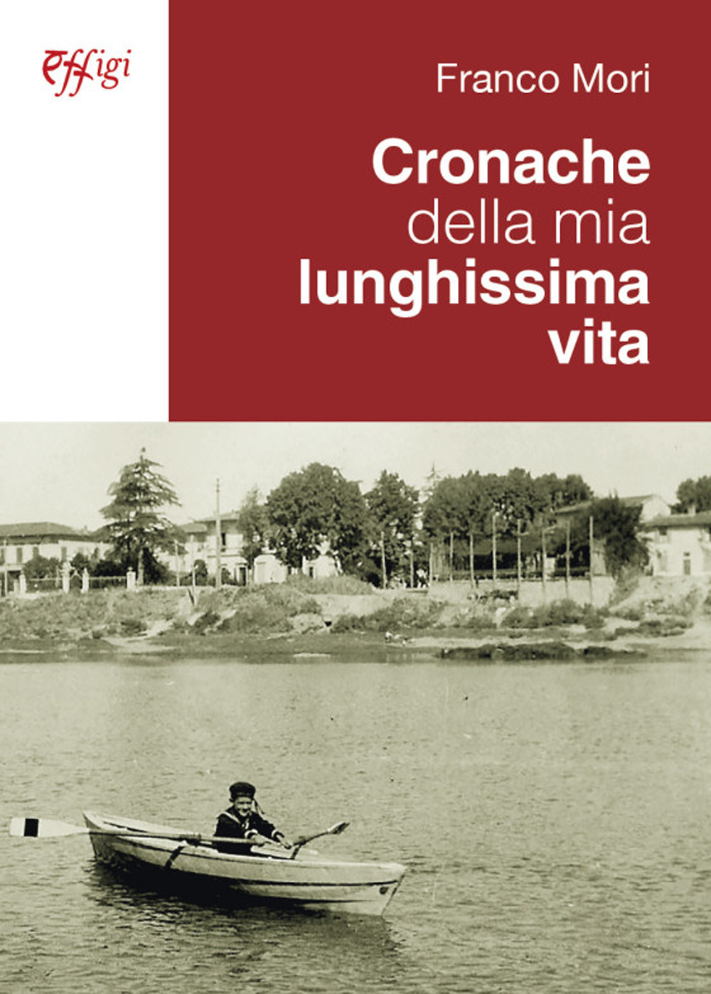 ibs